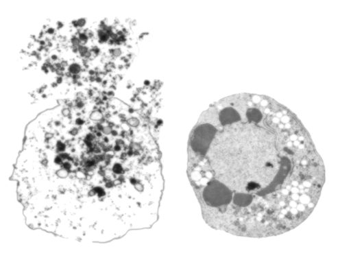 Necrosis (left) and apoptosis (right).