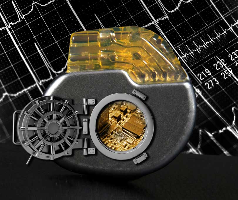 safe pacemaker illustration