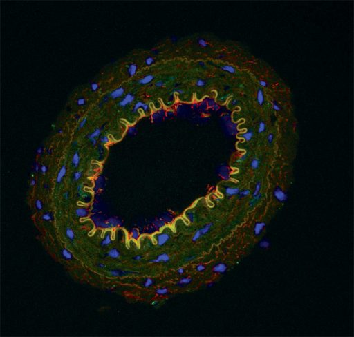 The fluorescent glow around this artery from a hypertensive rat shows the presence of Toll-like receptors activated by DAMPS. 